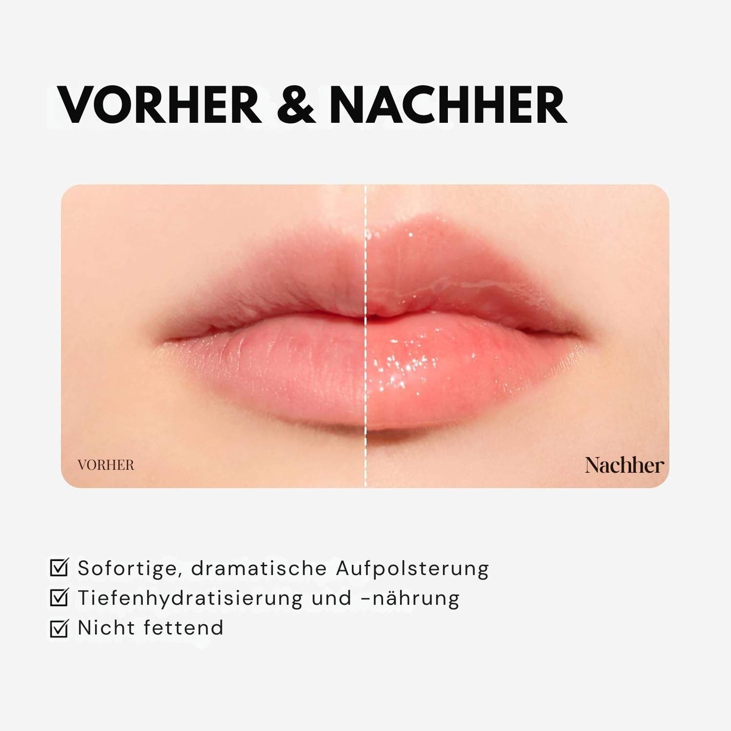 VT Cosmetics Reedle Shot Lip Plumper Expert 4,3g K Beauty Hautpflege für strahlende Haut