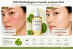 SKIN1004 Madagascar Ampoule 30ml K Beauty Hautpflege für strahlende Haut